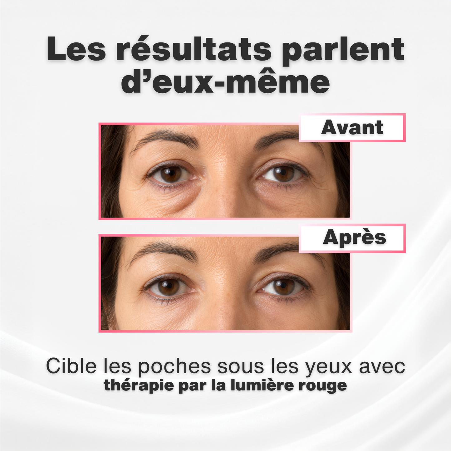 NovaSkin™ - Efface les poches hormonales naturellement.