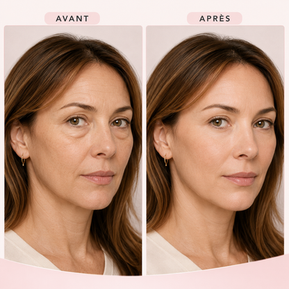 NovaSkin™ - Efface les poches hormonales naturellement.